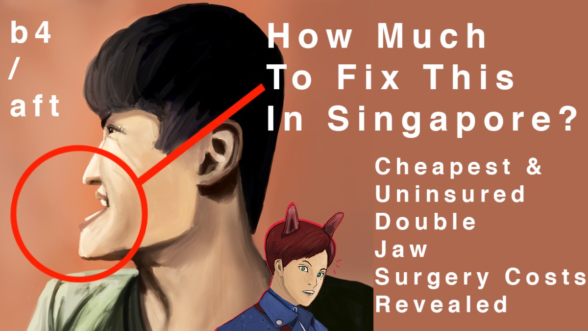 【b4/aft – Art Project】Singapore Double Jaw Surgery【Cheapest & Uninsured – Full&nbsp;Costs】